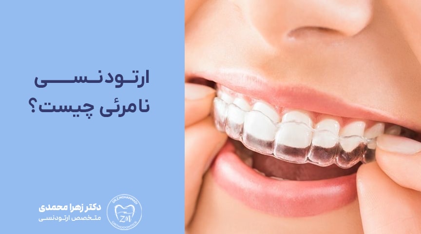 ارتودنسی نامرئی