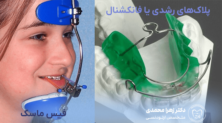 ارتودنسی متحرک