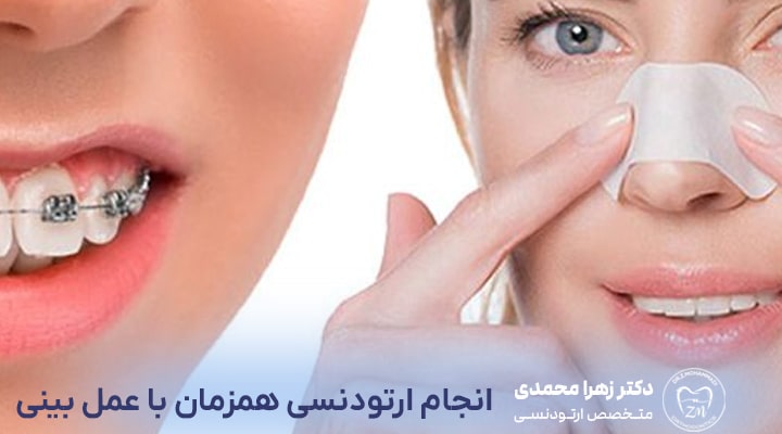 آیا می‌توان همزمان با ارتودنسی عمل بینی انجام داد؟