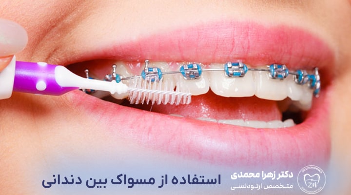 مسواک بین دندانی