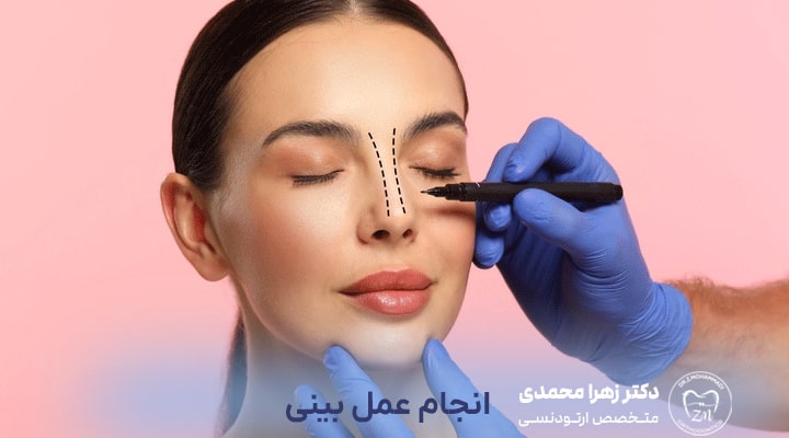 بهترین زمان انجام عمل بینی (رینوپلاستی)