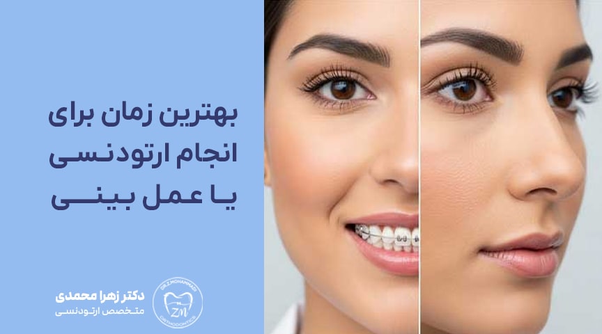 بهترین زمان برای انجام ارتودنسی