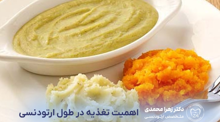 اهمیت تغذیه در طول درمان ارتودنسی