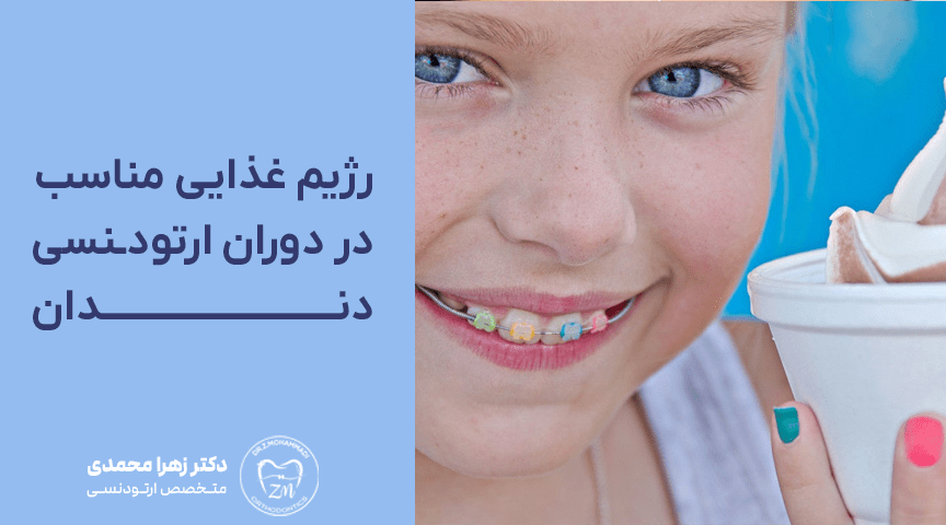 رژیم غذایی مناسب در دوران ارتودنسی دندان