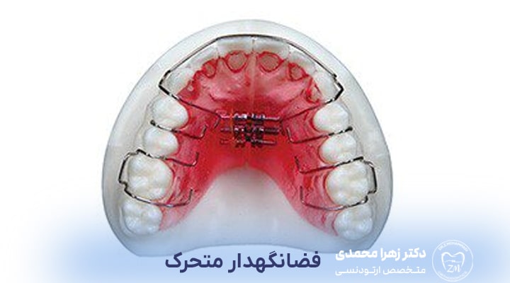 فضانگهدار متحرک