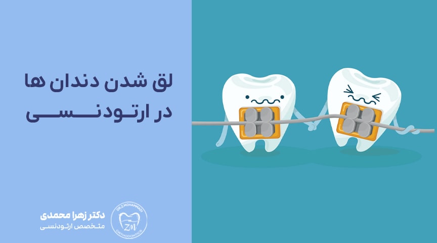 آیا لق شدن دندان در ارتودنسی طبیعی است؟