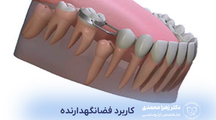 کاربرد فضانگهدار در کودکان و بزرگسالان