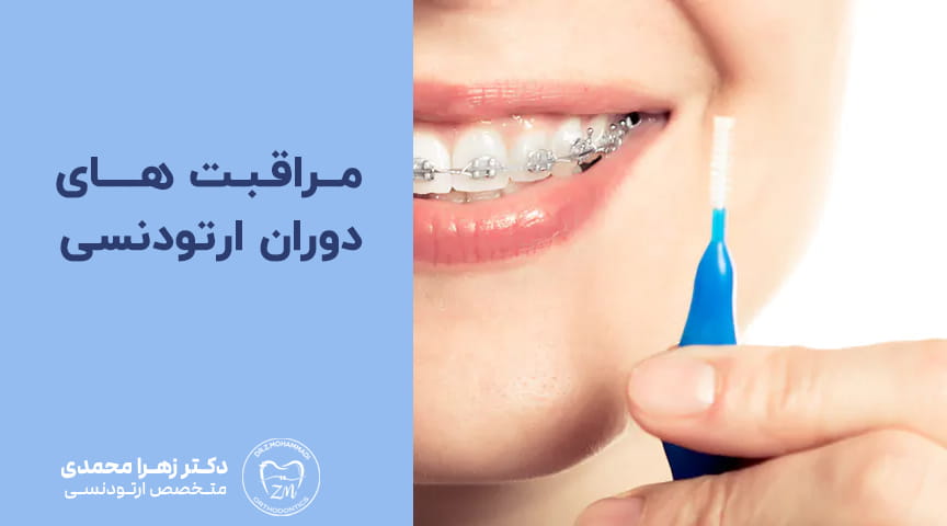 مراقبت های دوران ارتودنسی