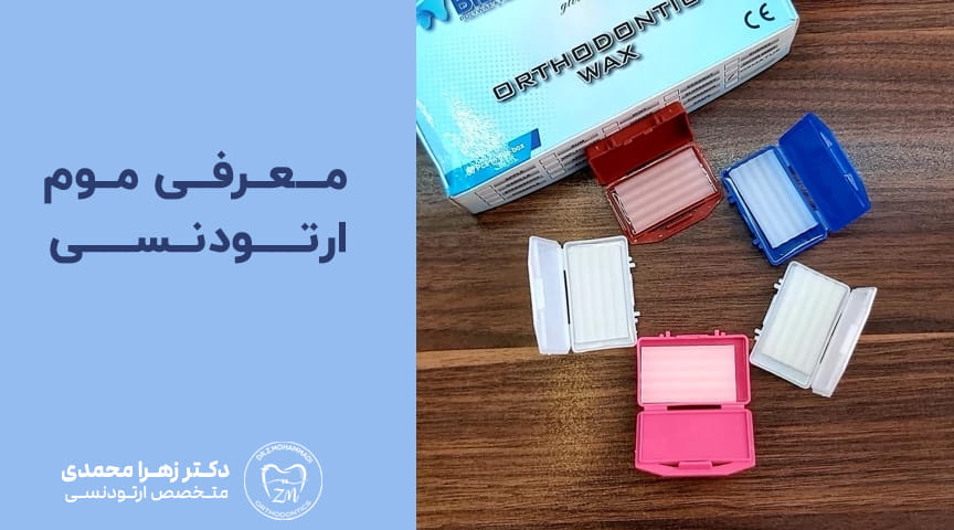 معرفی موم ارتودنسی و نکات اساسی برای استفاده