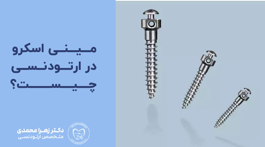 مینی اسکرو (پیچ) در ارتودنسی چیست؟