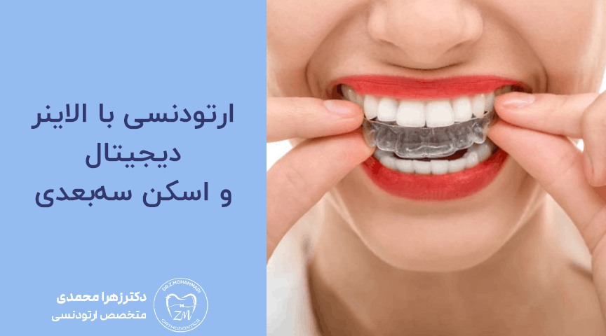 ارتودنسی با الاینر دیجیتال و اسکن سه‌بعدی