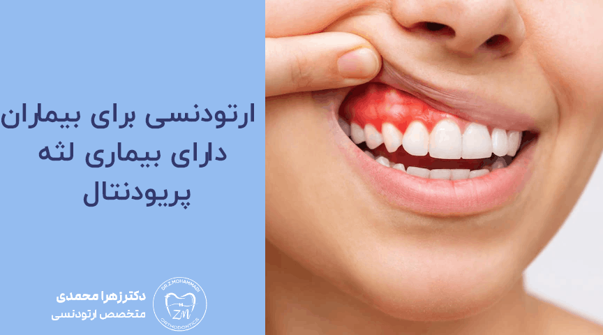 ارتودنسی برای بیماران دارای بیماری لثه (پریودنتال)