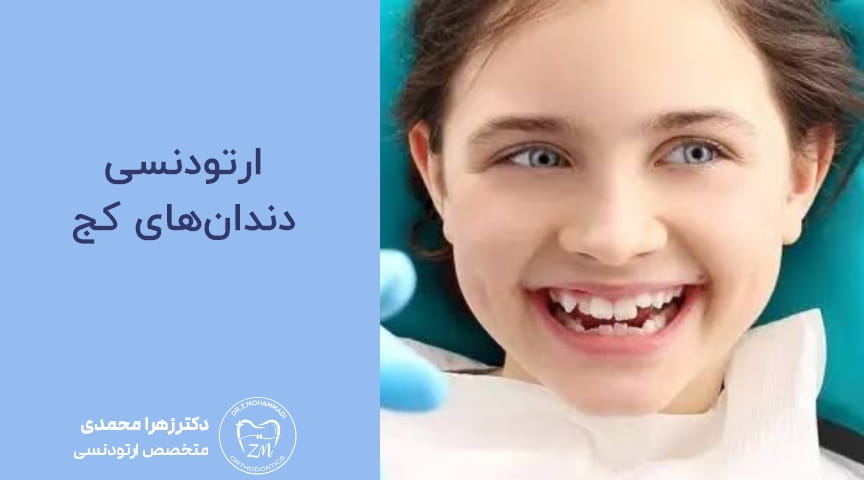 ارتودنسی دندان‌های کج