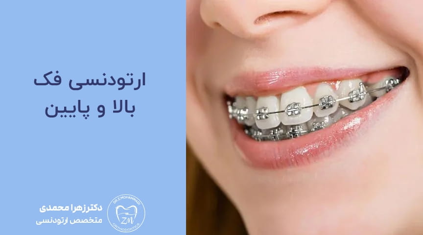 ارتودنسی فک بالا و پایین
