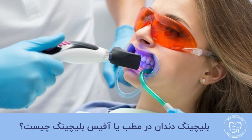 بلیچینگ دندان چیست؟
